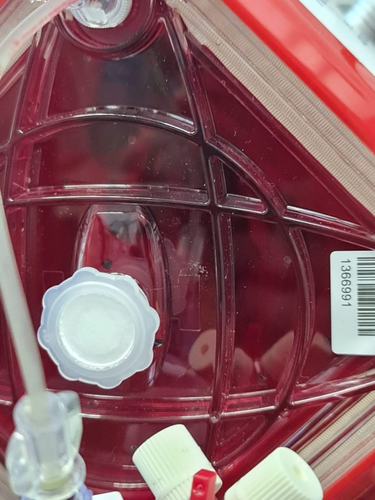 ECMO Troubleshooting Masterclass: Rapid Recognition & Crisis Management